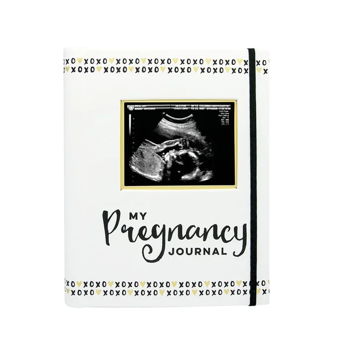 Pregnancy Journal – Black & White
